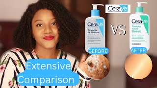 Which is best for your Acne Prone Skin Cerave SA Cleanser Vs Cerave Foaming Cleanser [upl. by Acino]