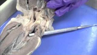 Mrs Johnsons Sheep Heart Dissection [upl. by Selassie]