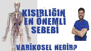 Varikosel Nedir ve Neden Olur [upl. by Ozne]