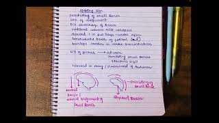 Spalding sign  forensic medicine  mbbs third year [upl. by Aihsek]