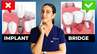 This ONE Thing Changed My Mind about Dental Implants [upl. by Anaugahs]