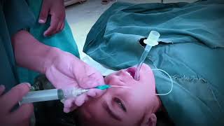 General Anesthesia Intubation Procedure  Intubation Procedure Done Smoothly By  Anesthetic Waseem [upl. by Yecies954]