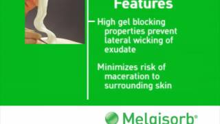 Benefits of Molnlycke Melgisorb Ag Calcium Alginate Dressing [upl. by Eyoj629]