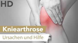 Arthrose im Kniegelenk Wie sie entsteht amp was du tun kannst [upl. by Atteyram]