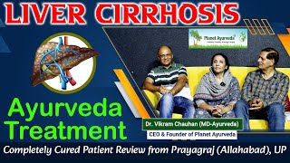 Liver Cirrhosis Ayurveda Treatment  Completely Cured Patient Review from Prayagraj Allahabad UP [upl. by Neiht]