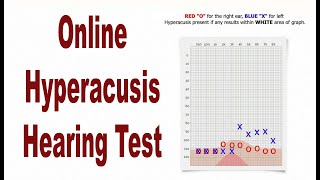 Hyperacusis Online Hearing Test Lowest Discomfort Level or LDL [upl. by Rothberg]