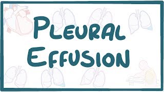 Pleural Effusion  causes symptoms diagnosis treatment pathology [upl. by Solegnave]