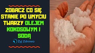 ✅ Zobacz co się stanie po umyciu twarzy olejem kokosowym i sodą ✅ [upl. by Erleena]