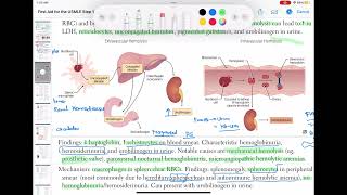 Extravascular hemolysis haematology 44 First Aid USMLE Step 1 in UrduHindi [upl. by Compte]