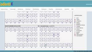 Scriptcase Odontograma [upl. by Ecirum]