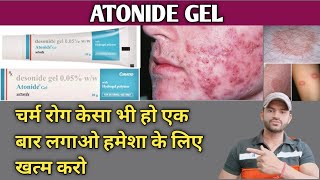 Atonide gel use dose benefits and side effects full review in hindi [upl. by Joselow]