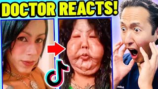 Plastic Surgeon Reacts to EXTREME Plastic Surgery TikTok Videos [upl. by Eissim640]