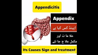 Appendix painappendicitis causescomplicationsdiagnostic test and treatmentviralvideomedical [upl. by Atsillak]