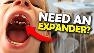 Getting a Palatal Expander What you NEED to know  McKinney Orthodontist [upl. by Culosio]