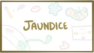 Jaundice  causes treatment amp pathology [upl. by Fergus445]