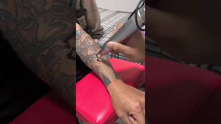 Hand small tattoo removal part 1 tattooartshorts [upl. by Norvall447]