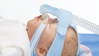 Application video of the BabyFlow plus  the superior solution for noninvasive respiratory support [upl. by Salamanca]