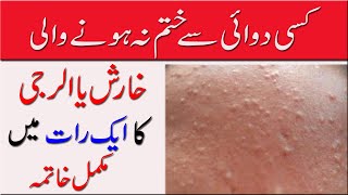 Kharash الرجی ka fori ilaj Top 3 Natural Remedies You Need to Try [upl. by Ahsiatal111]