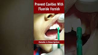 Prevent Cavities with Fluoride Varnish 🦷 cavities dental dentalshorts [upl. by Chilt]