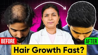 Hair Growth Tips Regrow Your Hair Fast Without Wasting Any Time [upl. by Dnalwor658]