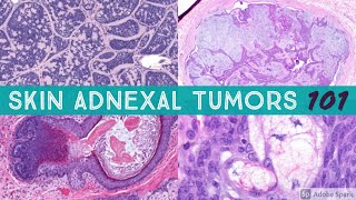 Skin Adnexal Tumors 101 A Basic Approach for General Pathologists [upl. by Leviralc]