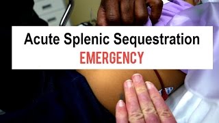 Sickle Cell Splenic Sequestration Emergency [upl. by Xino]