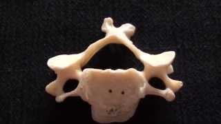 Cervical Vertebrae  Typical cervical vertebrae  Anatomy [upl. by Sirret]