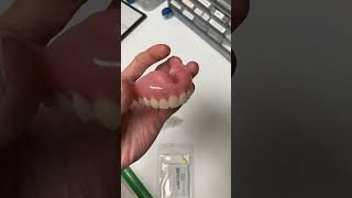 Implant Supported Dentures [upl. by Adekram]