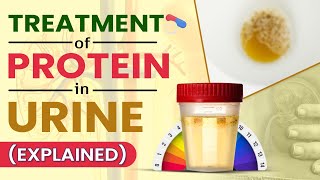 Treatment Of Protein In Urine Explained [upl. by Laney]