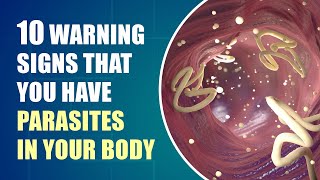 Dont Ignore These Early Symptoms of Parasites In Your Body [upl. by Vod]