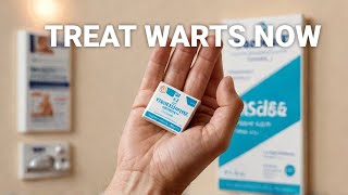 The Horrifying Types of Warts And How to Treat Them [upl. by Ortiz]