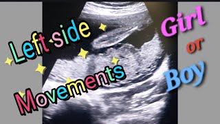 Posterior Placenta With Fetal Heartbeat 130bpm  Left side Baby Movement  27Weeks Baby Genderreveal [upl. by Len]