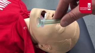 Nasopharyngeal Airway Insertion [upl. by Nelle]