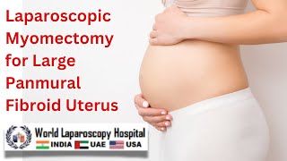 Laparoscopic Myomectomy for Large Panmural Fibroid Uterus An Ideal Surgical Approach [upl. by Thorin]