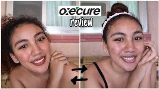 Oxecure Philippines  Product review  Experience  2 weeks HONEST review [upl. by Eisele]