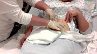 Colostomy Care Teaching Video [upl. by Enirhtac]