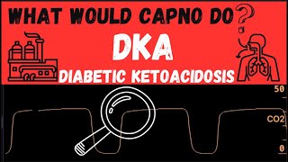 What would CAPNO do DKA [upl. by Lantha]