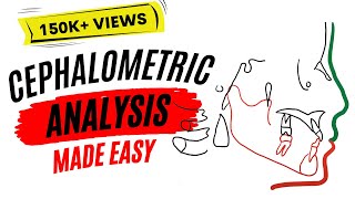 Cephalometric analysis [upl. by Norihs]