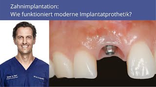 Zahnimplantation Wie funktioniert moderne Implantatprothetik [upl. by Krum]