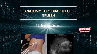 ULTRASOUND OF THE SPLEEN Normal Echograophy of the Normal Spleen Échographie de la rate normale [upl. by Austreng473]