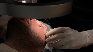 I Filmed My ENTIRE LASIK Surgery You Wont Believe What Happened Next [upl. by Atiken328]