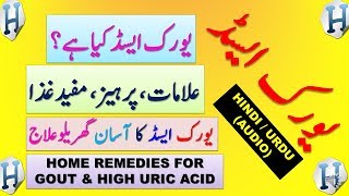 Uric Acid  Gout  Arthritis  Gathiya Symptoms amp Treatment At Home And Foods To Avoid In Hindi Urdu [upl. by Nart73]