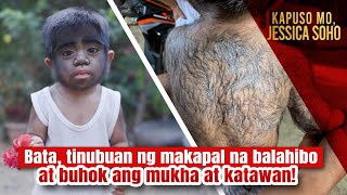 Bata tinubuan ng makapal na balahibo at buhok ang mukha at katawan  Kapuso Mo Jessica Soho [upl. by Mandler]