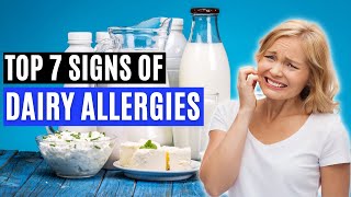 Top 7 Signs of a Dairy Allergy Signs of CMPA [upl. by Nnyrat678]