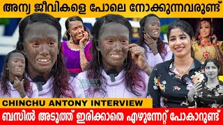 അന്യ ജീവികളെ പോലെ നോക്കുന്നവരുണ്ട്😪 CHINCHU ANTONY INTERVIEW  VARIETY MEDIA [upl. by Ile]