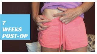 7 Week Post Op Update  Bladder Sling Bladder Lift Ovarian Tumor Cyst Removal amp More [upl. by Zweig93]