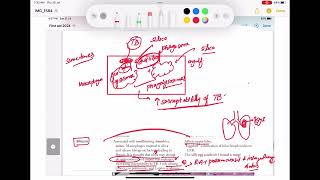 Pneumoconiosis Asbestosis Silicosis Berylliosis coal work Respiratory 42 First Aid USMLE Step1 [upl. by Asseram]