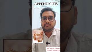 Acute appendicitis treatment I Treatment for acute appendicitis in Delhi Noida [upl. by Haseefan]