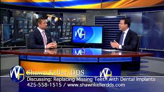 All ON 4 Dental Implants with Kirkland WA Dentist Shawn Keller DDS [upl. by Pimbley]