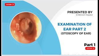 Examination of Ear Part 2 Otoscopy of Ear  ENT Made easy by r Mishi Bhatti  Part 1 [upl. by Banks157]